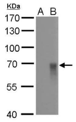 Influenza A H1N1 Hemagglutinin Antibody (GT521) - (A/WSN/1933), Novus Biologicals 100 &mu;g | Buy Online | Novus Biologicals | Fisher Scientific